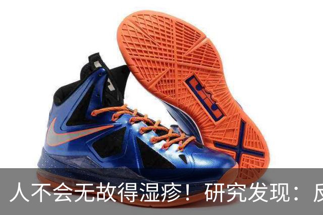人不会无故得湿疹！研究发现：反复发作的人，多半有这3个习惯